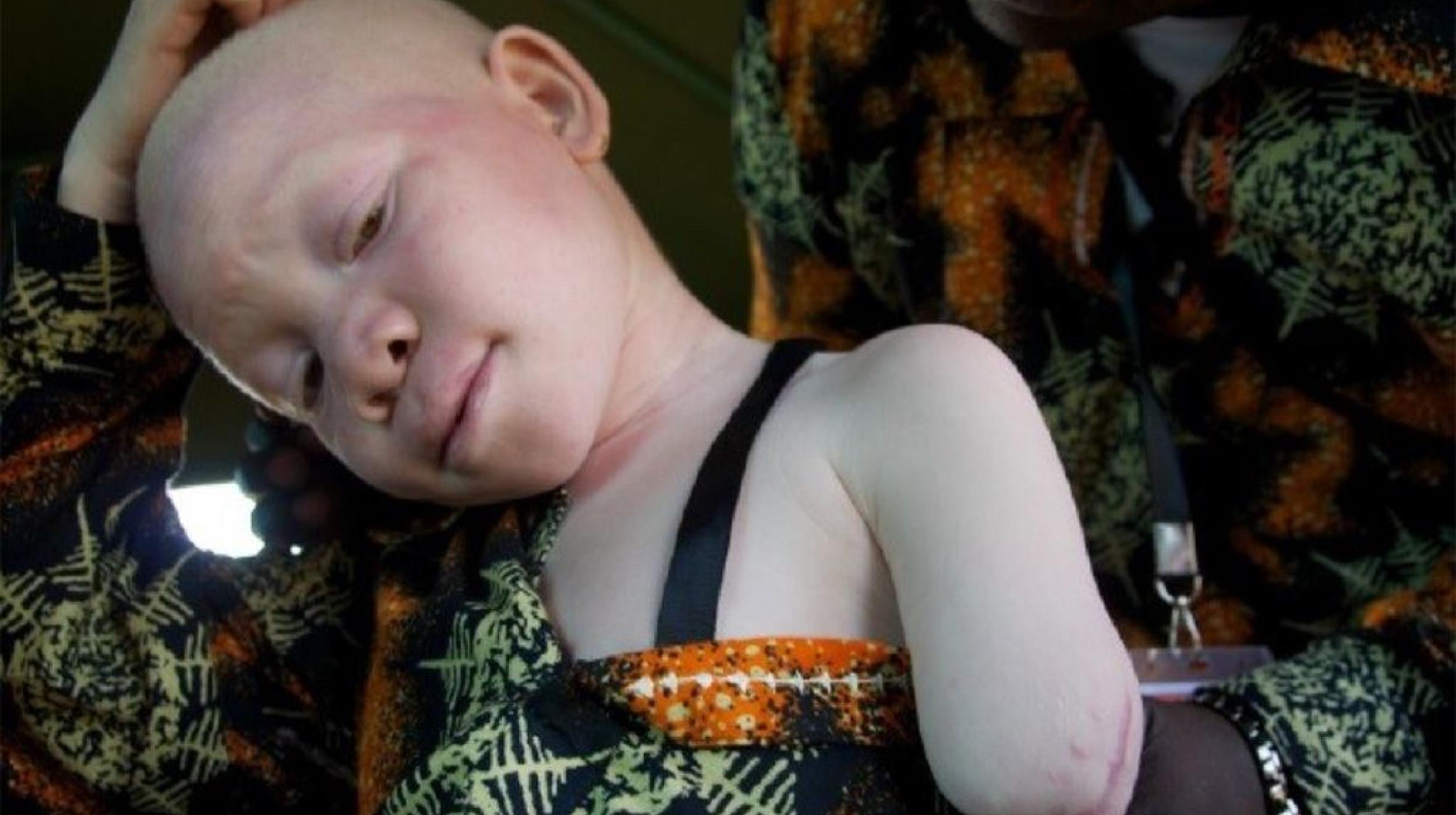 Witchcraft and Human Rights: From Horror to Hope